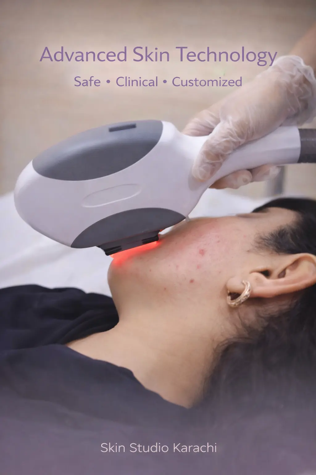 Advanced skin treatment technology at Skin Studio Karachi